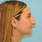 B&A