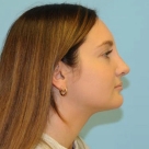 B&A