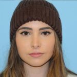 Rhinoplasty Before & After Patient #567