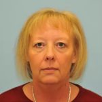 Facelift Before & After Patient #256