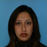 Rhinoplasty Before & After Patient #534