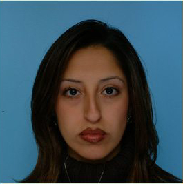 Rhinoplasty Before & After Patient #534