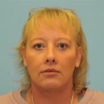 Facelift Before & After Patient #256