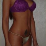Liposuction Before & After Patient #499