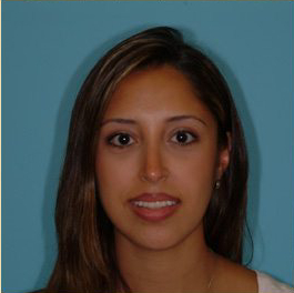 Rhinoplasty Before & After Patient #534