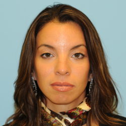 Rhinoplasty Before & After Patient #2847