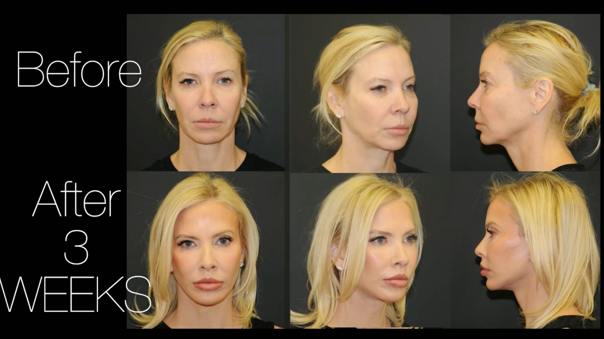 Berlet Plastic Surgery preview